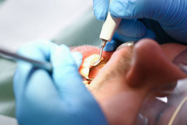Best Dental Abscess Treatment in Howell, MI