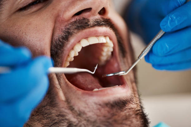 Best Emergency Denture Repair in Howell, MI